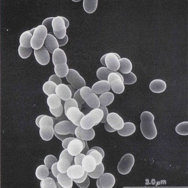 Lactobacillus Acidophilus for Human Gut Health Ibs