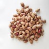 New Crop Best Price Light Speckled Kidney Beans