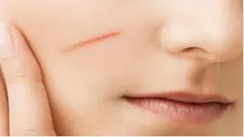 90% Soluble Beta Glucan for Skin From Yeast Saccharomyces Cerevisiae